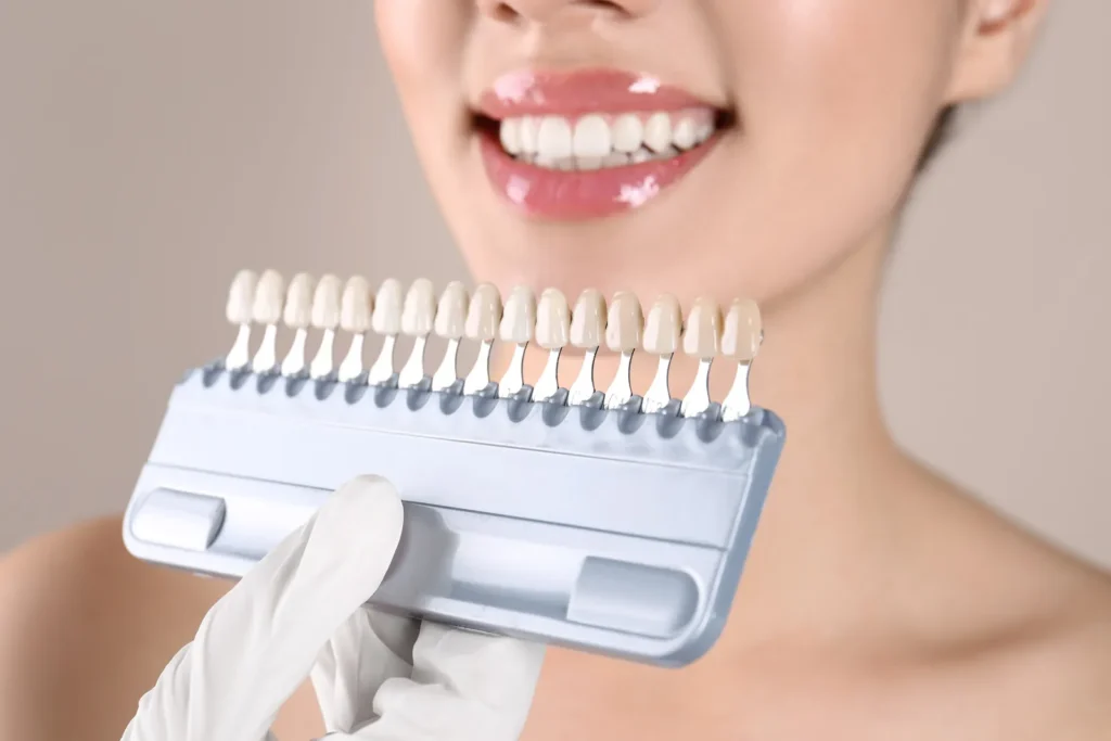 A shade guide held beside a bright smile