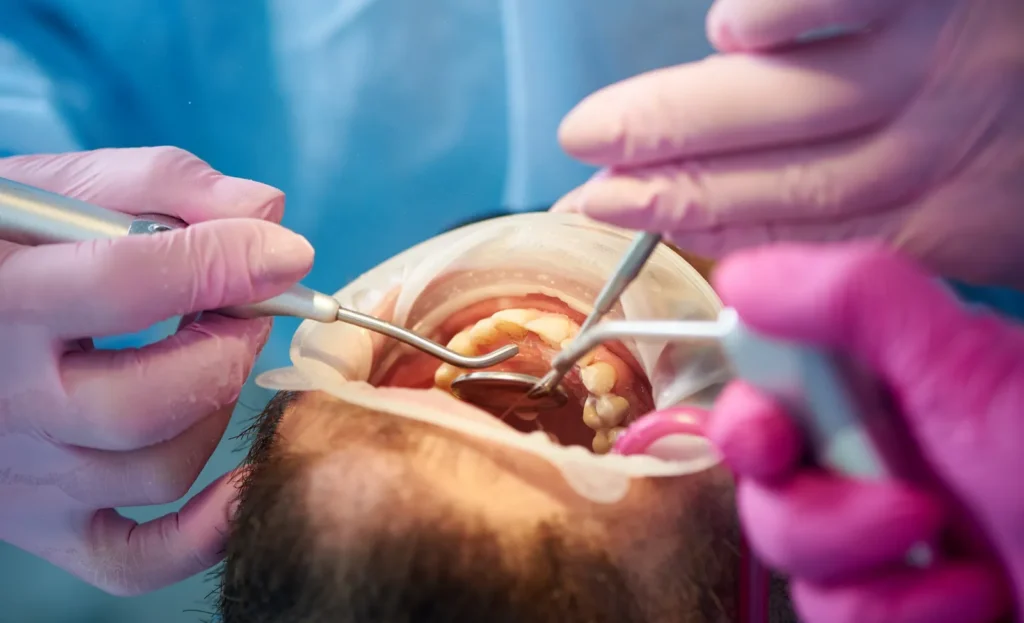 Periodontal surgery in progress