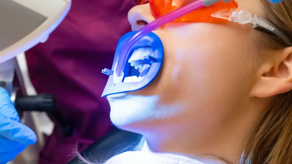 An in-office whitening treatment under a curing light